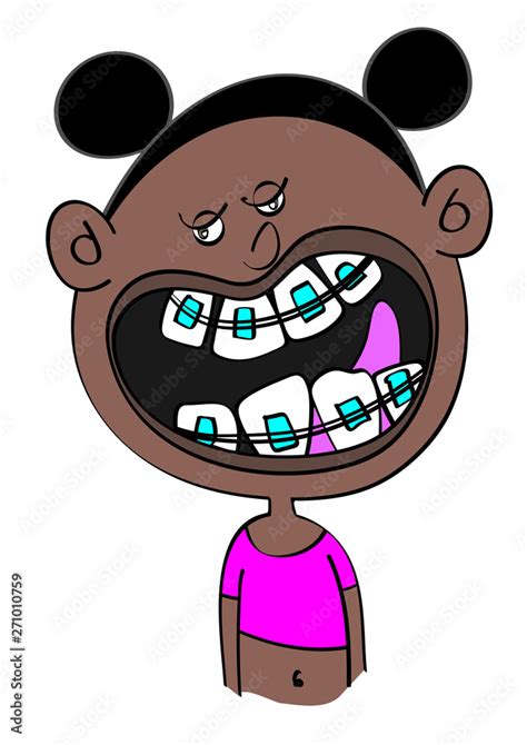 funny black girl with dental braces cartoon vector illustration Stock ...