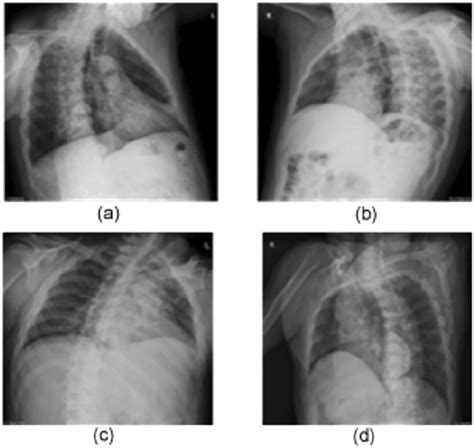 Different angles of oblique projection. (a), (c) left anterior oblique... | Download Scientific ...