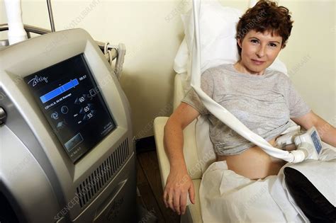 Cryolipolysis treatment - Stock Image - C015/4716 - Science Photo Library