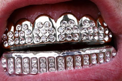 Grillz: Alles, was Sie über dem neuen Zahn Trend wissen müssen - ilovemysmile