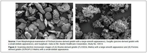 20 Years of Floseal Hemostatic Agent Use in Neurology and Spinal Surgery | SciTechnol