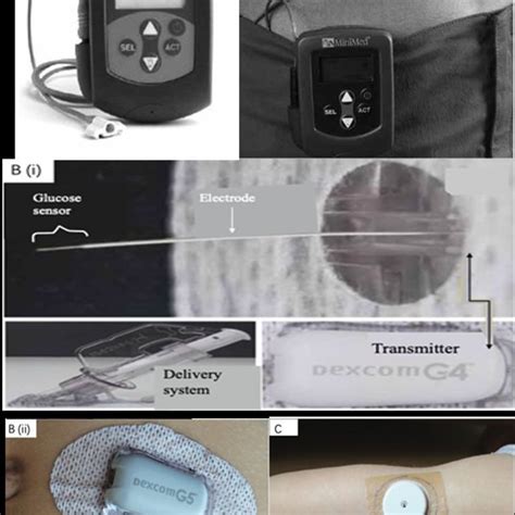 Commercialized wearable CGM devices. (A) The Medtronic MiniMed CGMS its | Download Scientific ...