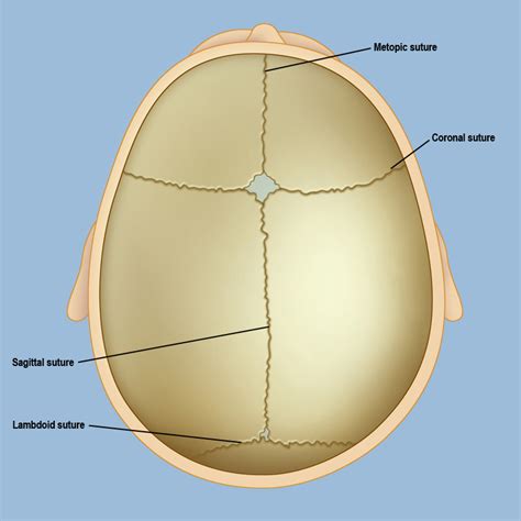 Craniosynostosis | Weill Cornell Brain and Spine Center