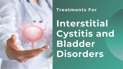 Treatments For Interstitial Cystitis and Bladder Disorders - YouTube