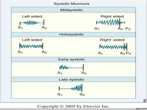 Systolic murmurs