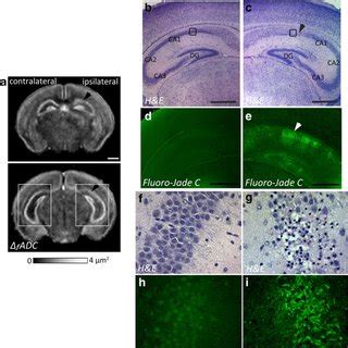 Oscillating-gradient diffusion MRI and histopathological assessment of ...