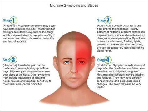 Medical Addicts: Migraine Symptoms, Signs and Treatment