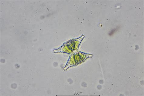 Staurastrum | The Microscopic Life of Shetland Lochs