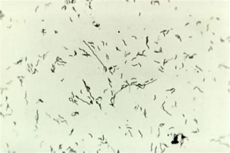 2013s1-34b-Campylobacter