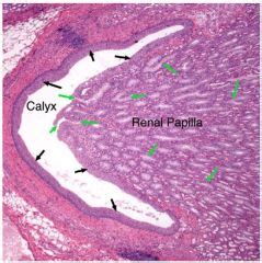 Renal Papilla Histology