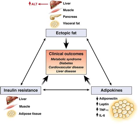 Implications of Elevated Serum Alanine Aminotransferase Levels: Think Outside the Liver ...