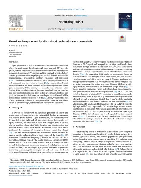 (PDF) Binasal hemianopia caused by bilateral optic perineuritis due to sarcoidosis