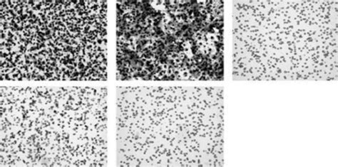 Cell migration (A) and statistical analysis (B) of cell migration in ...