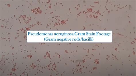 Gram Negative Rods of Pseudomonas aeruginosa - YouTube