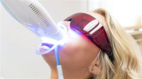 Laser Teeth Whitening Near Me | Philips Zoom | SW15