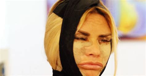 Katie Price's plastic surgery timeline as she ‘regrets’ latest facelift ...