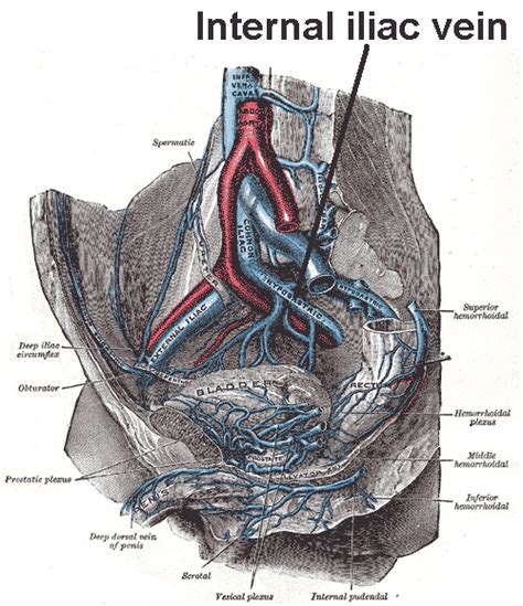 Internal iliac vein - wikidoc