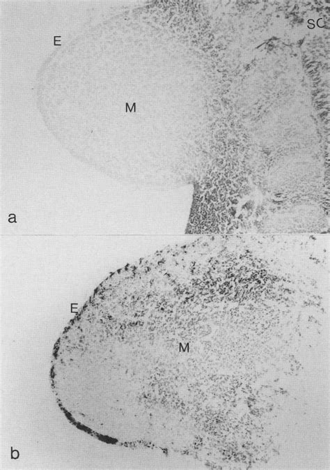 Hind limb buds from untreated and RA-treated Tgl2 embryos. (al... | Download Scientific Diagram