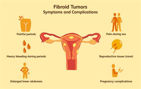 What is uterine fibroids? Causes, symptoms and types of the benign tumors