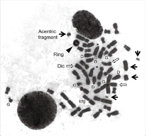 Representative image of a metaphase spread with diverse... | Download Scientific Diagram