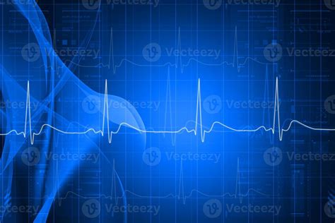 Digital illustration of heart monitor screen with normal beat signal ...