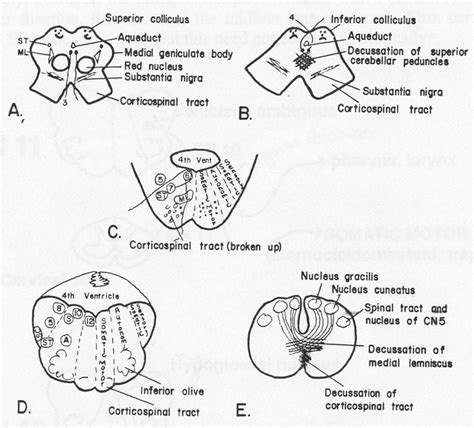 Brainstem Rules of 4 • LITFL • Neurology Clinical exmaination