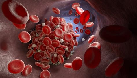 An unusual side effect of anticoagulants - DrugCard