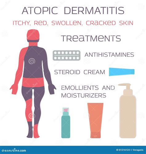 Atopic Dermatitis Eczema Cartoon Vector | CartoonDealer.com #120994175