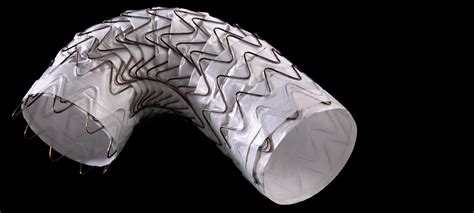 Gore Receives FDA Approval for GORE® TAG® Conformable Thoracic Stent Graft - iData Research