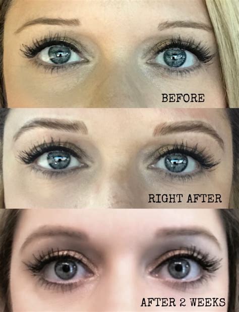 Eyebrow Microblading: My Personal Experience (Part 1)