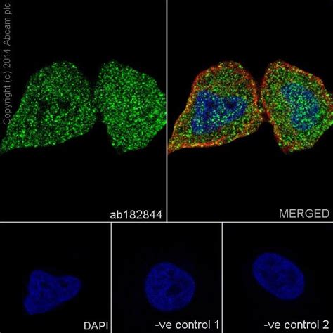 Anti-Hsp70 antibody (ab31010) | Abcam