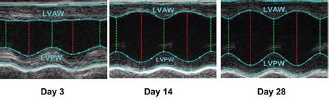 Scientists find way to heal scars left behind by heart attacks | The National Tribune