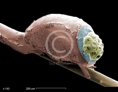 egg (nit) of a human head louse (Pediculus humanus). Magnified 145x...Head Hunters the Head Lice ...