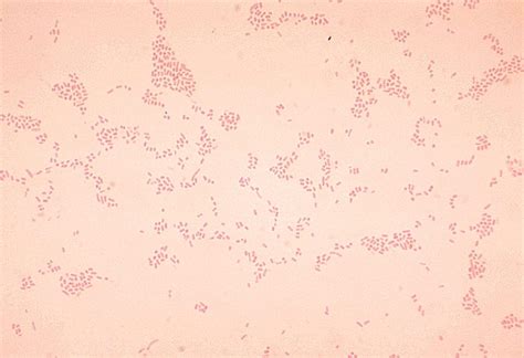 Actinobacillus - MRGI - Microbiota Research Group of Iran