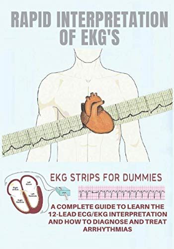 Rapid Interpretation of EKG's: EKG strips for dummies And A Complete Guide to Learn The 12-Lead ...