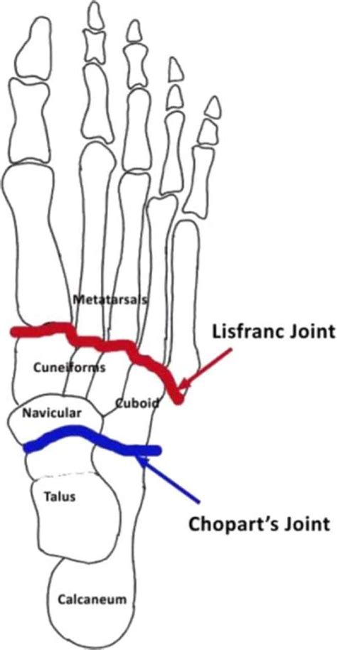 Lisfranc Injuries Of The Foot: An Injury You Must Respect – Howard J ...