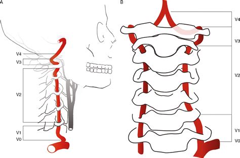 Vascular anatomy - NeurologyNeeds.com