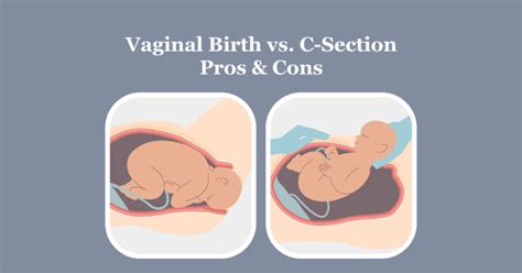 VAGINAL BIRTH VERSUS C-SECTION PROS AND CONS – Mamaway (Philippines)