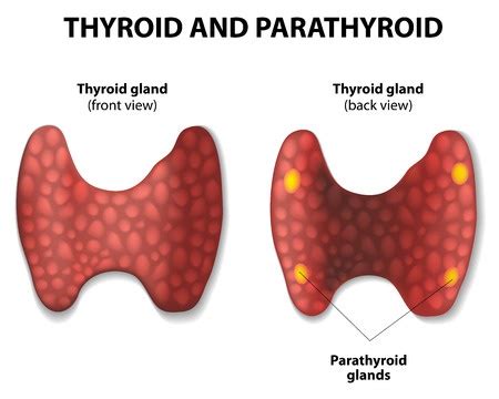 Parathyroid Surgery (Parathyroidectomy) - Treatment in Israel | D.R.A Medical