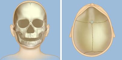 Symptoms of Craniosynostosis | Brain & Spine Center