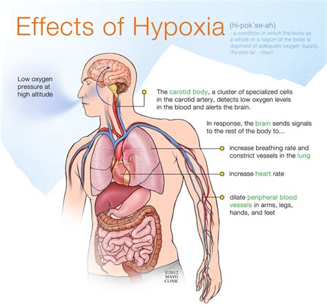 What are the common causes of hypoxia? – First aid for free