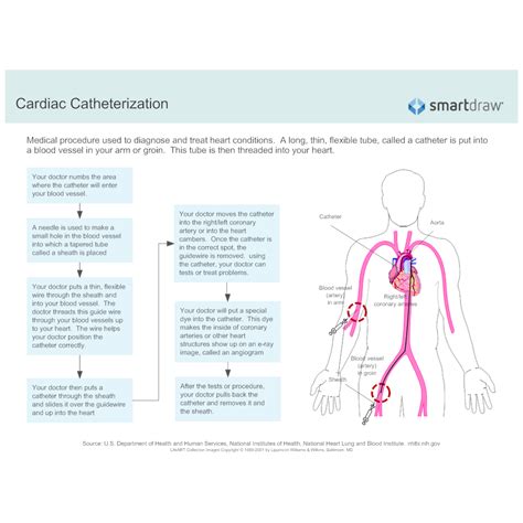 Cardiac Catheterization Procedure