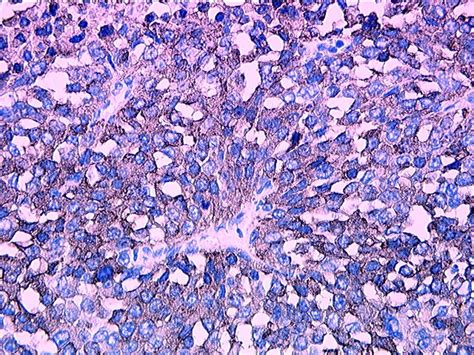 Adrenal gland and paraganglia - General