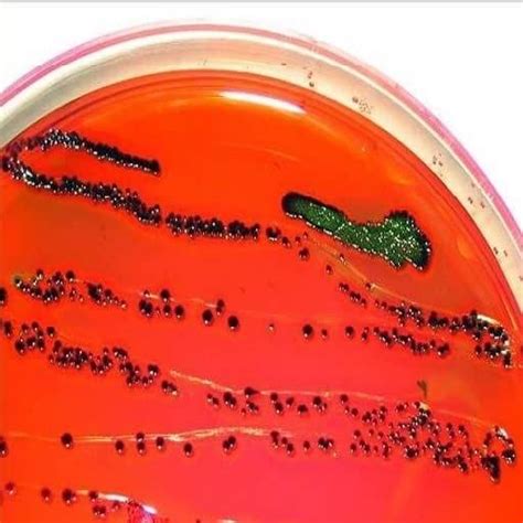 Morphology & Culture Characteristics of Escherichia coli (E. coli)