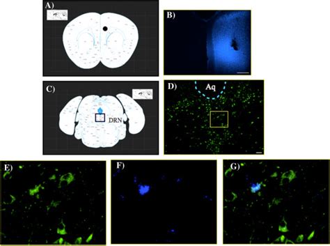 Projection of 5-HT neurons from the dorsal raphe nucleus (DRN) to the ...