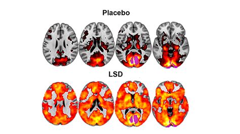 A Team of European Researchers Is Crowdsourcing the World’s First ‘Self-Blinded’ LSD Microdosing ...