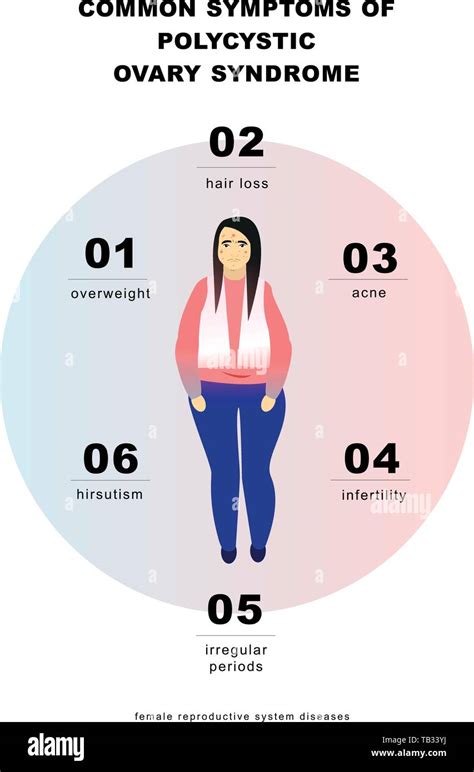 PCOS Symptoms infographic. Vector illustration Stock Vector Image & Art ...