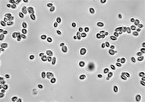 Morfologi Saccharomyces Cerevisiae