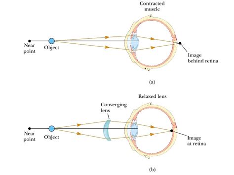 Where does a farsighted eye focus an image? | Socratic