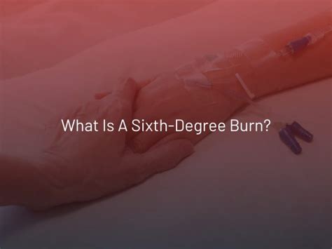 What is a Sixth-Degree Burn?
